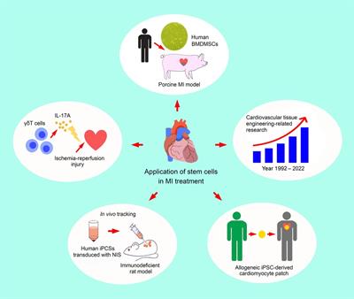 Editorial: [Application of stem cells in the treatment of myocardial infarction]